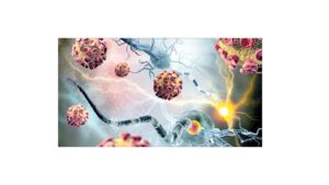 بررسی جامع و کامل جایگزین متیلن کلراید 4 جایگزین های متیلن کلراید